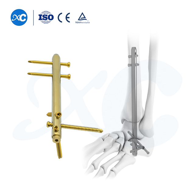 ಹಿಂಡ್‌ಫೂಟ್ ಫ್ಯೂಷನ್ ಆಂಕಲ್ ನೈಲ್ - XC ಮೆಡಿಕೋದಲ್ಲಿ ಉತ್ಪನ್ನವನ್ನು ಖರೀದಿಸಿ