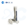 Pl&aacute;ta Glas&aacute;la Tibiofibular Distal-III - Ceannaigh T&aacute;irge ar XC Medico