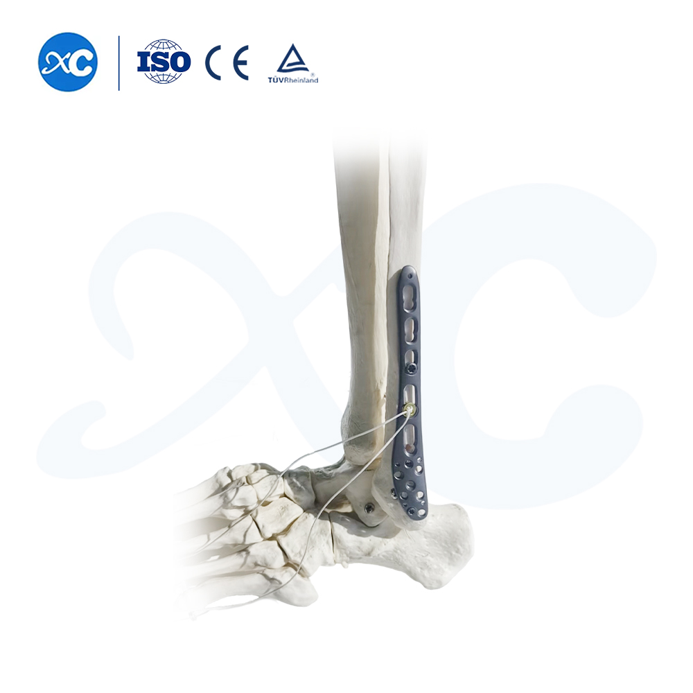 Pl&aacute;ta Glas&aacute;la Tibiofibular Distal-III - Ceannaigh T&aacute;irge ar XC Medico