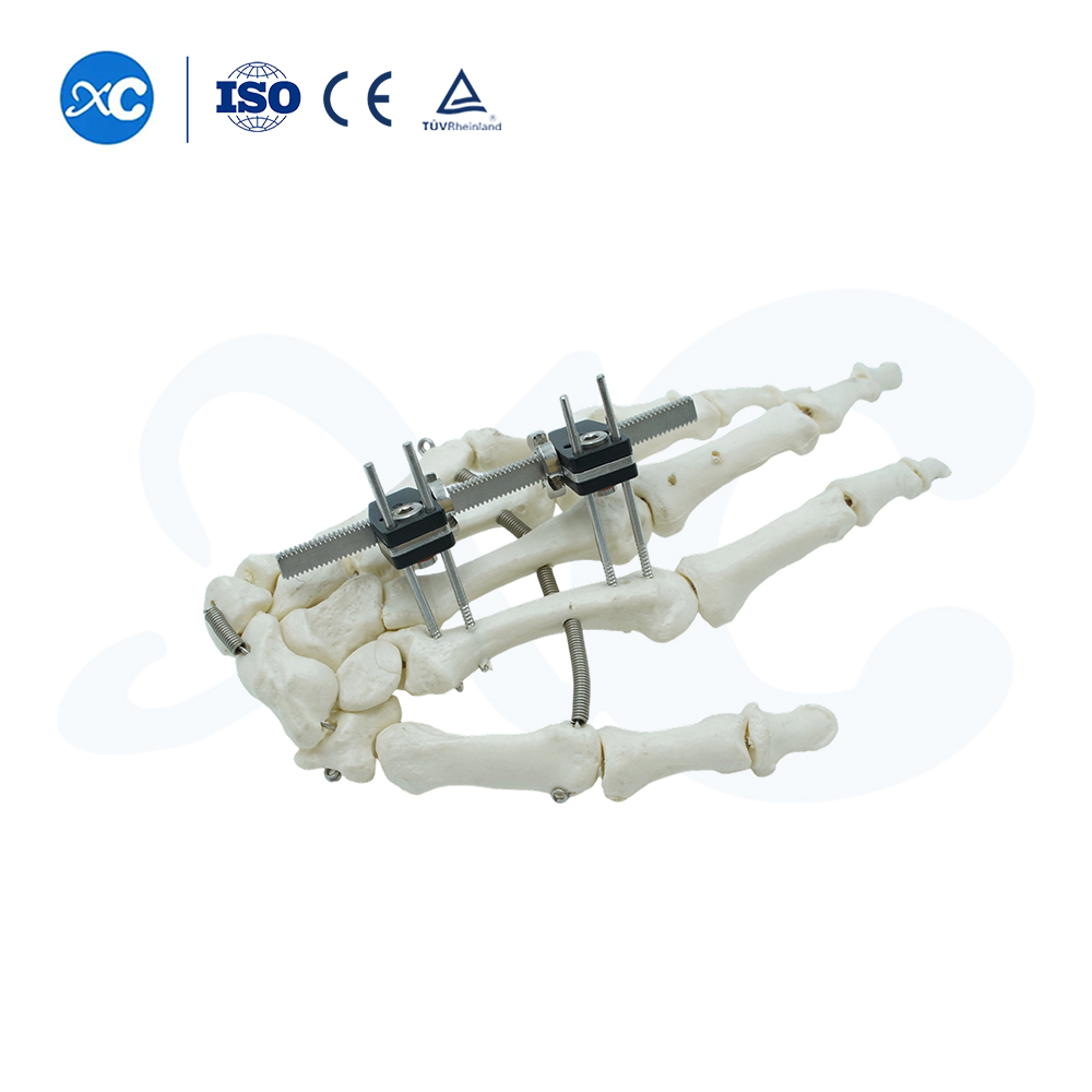 Mini fiksator ravnog tipa