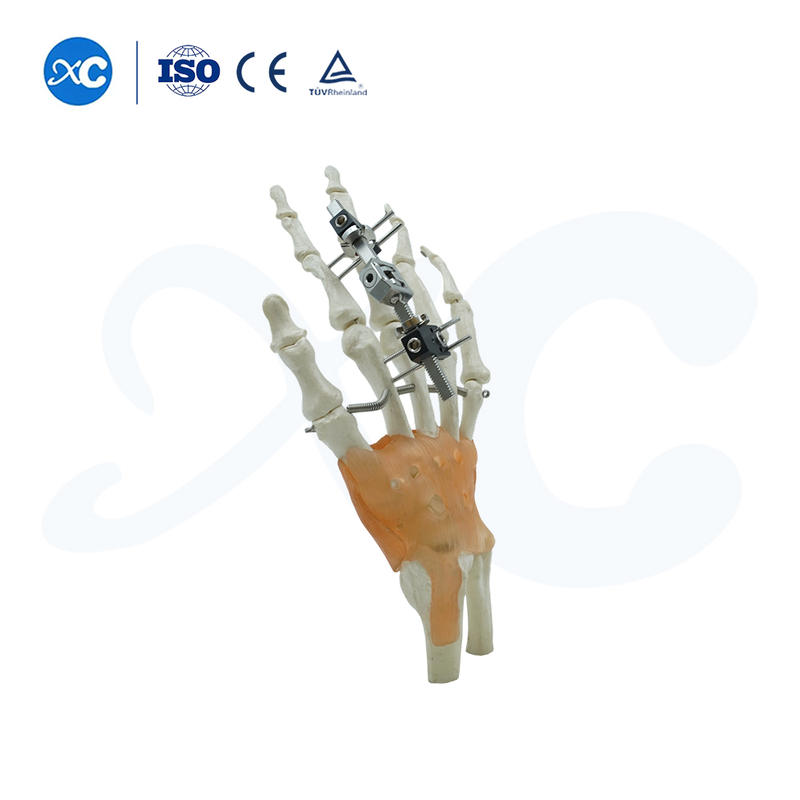 Mini externe Fixator fir Metacarpal & Phalange Frakturen | XC Medico -1