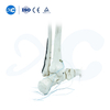 Pl&aacute;ta Glas&aacute;la Tibiofibular Distal-III - Ceannaigh T&aacute;irge ar XC Medico