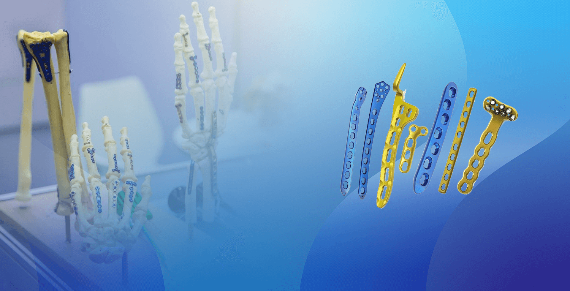 Кулпуланган пластина имплантат banner.png жок