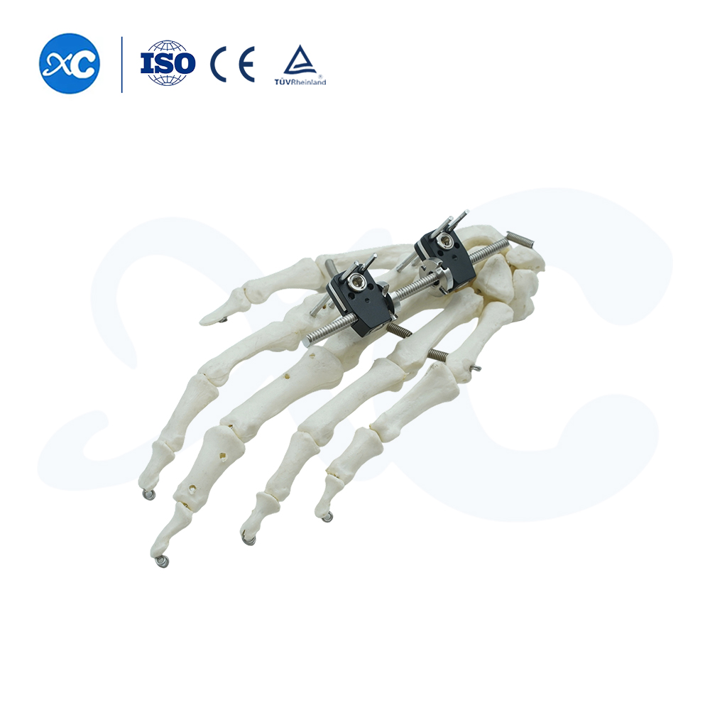 Mini Fixator Ncaj Hom