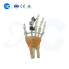 Mini externe Fixator fir Metacarpal & Phalange Frakturen | XC Medico -3