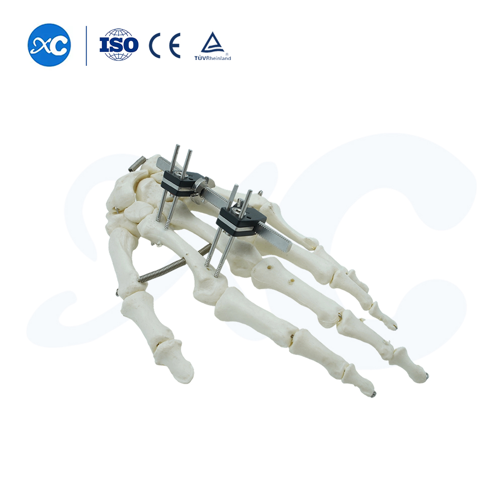 Mini Fixator Ncaj Hom