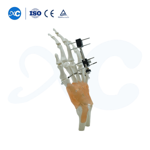 Mini Fixator Universal Compression Extension Hom