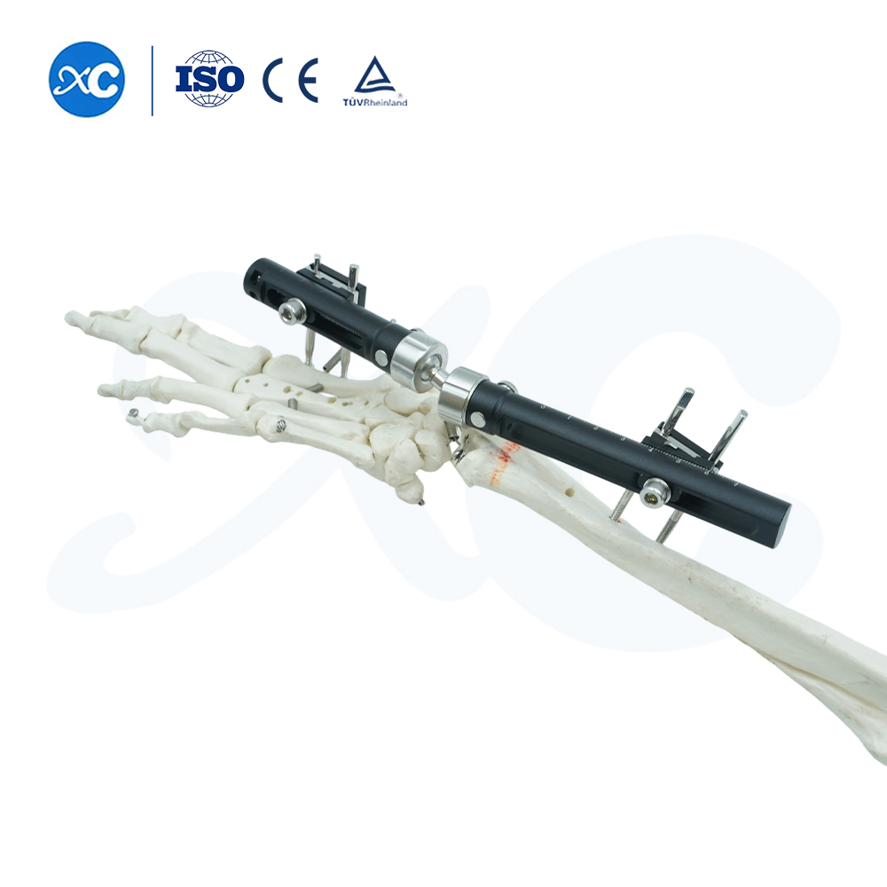 Fixador extern de canell-Tipus est&agrave;ndard