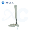 Pl&aacute;ta Glas&aacute;la Tibiofibular Distal-III - Ceannaigh T&aacute;irge ar XC Medico