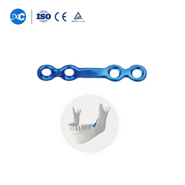 2.0 Retromolar Triangle Alveolar Ridge لاکنگ پلیٹ