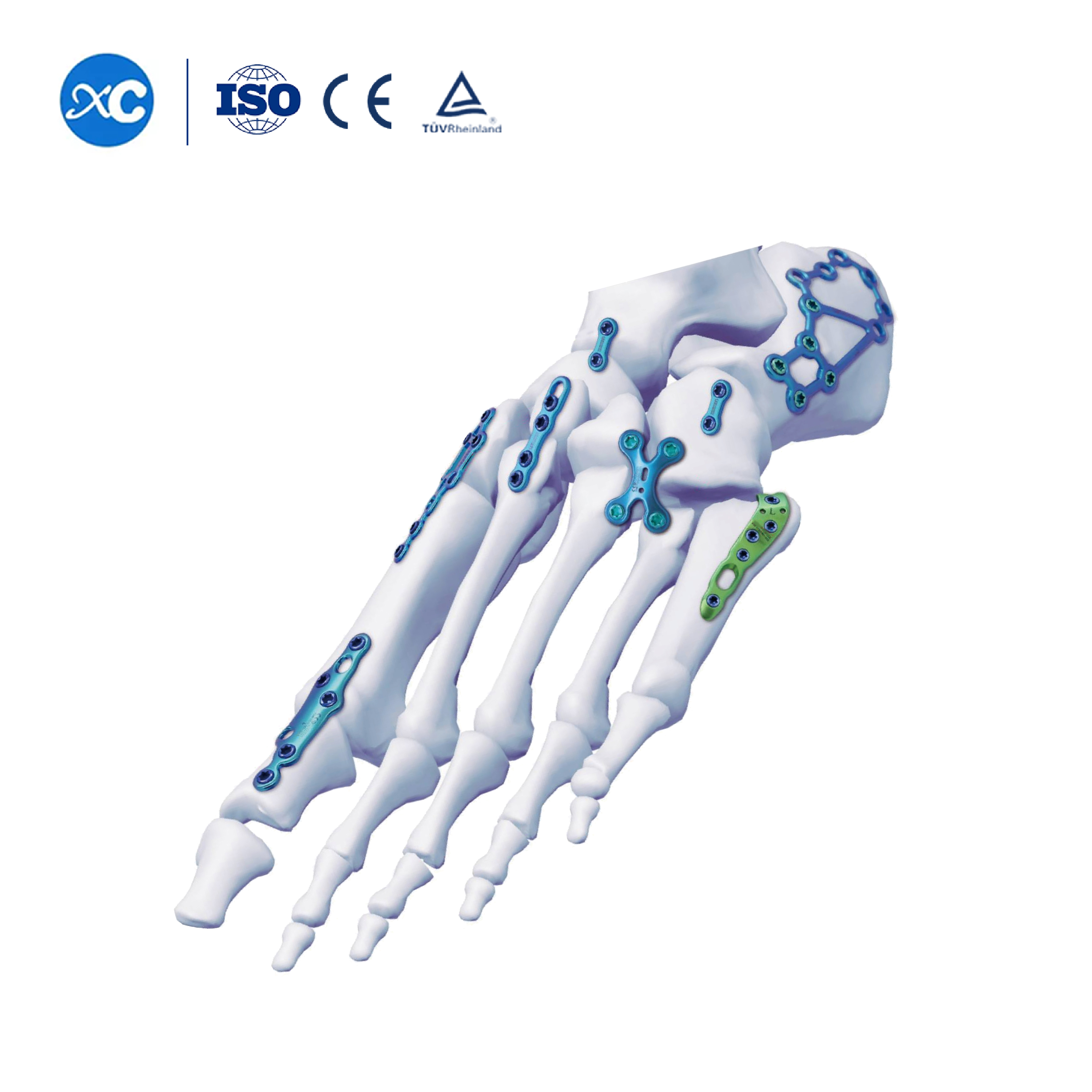 Ẹsẹ Ati kokosẹ Titiipa Awo System