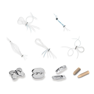 स्नायुबंधन निर्धारण प्रणाली