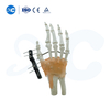 جێگیرکردنی دەرەکی بۆ Metacarpals And Phalanges - بەرهەمەکە لە XC Medico بکڕە