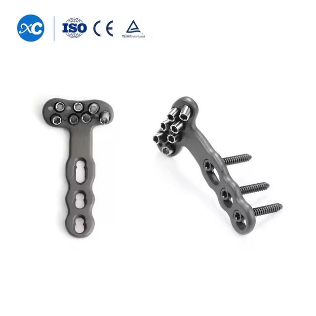 Distale Radius Sperrplate DVR