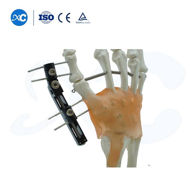 Mini Fixator Streck horizontal Achs Typ