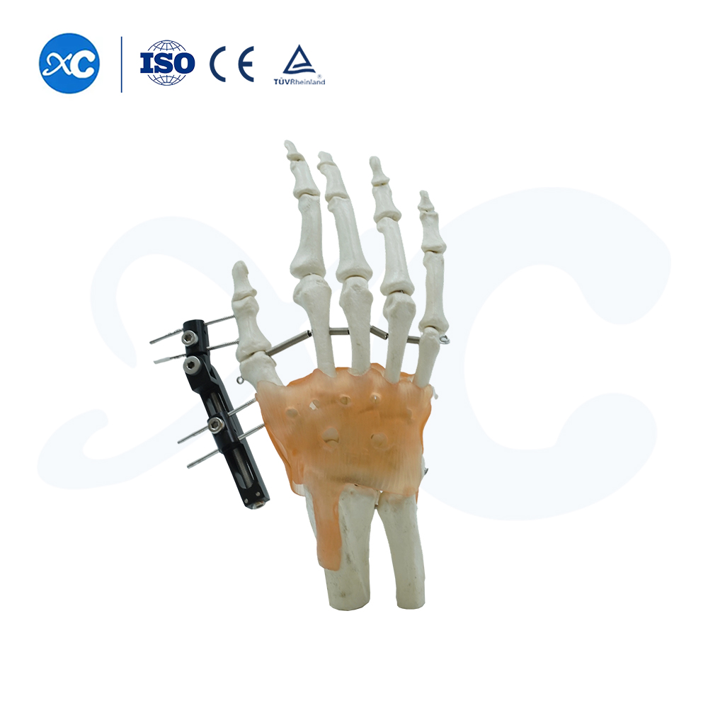 Mini Fixator Track ประเภทแกนนอน