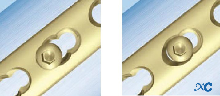 Behoorlike gebruik van die sluitplaat!