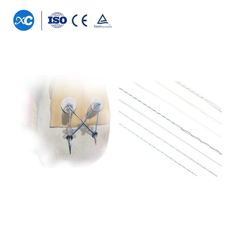 UHMWPE Sports Medicine Suturer f&ouml;r senor & ligament reparation | XC Medico - 1