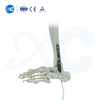 Distal Tibiofibular Locking Plate-III - Ixtri Prodott fuq XC Medico