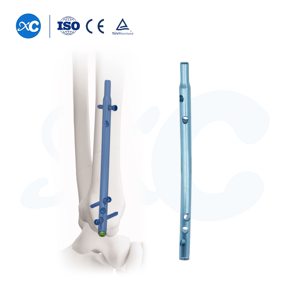 Distal Tibial လက်သည်း | Retrograde Intramedullary Fixation စနစ် | XC Medico အရိုးအထူးကု