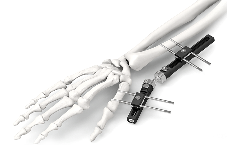 Monolateral Faiga Fa'atonu Fafo