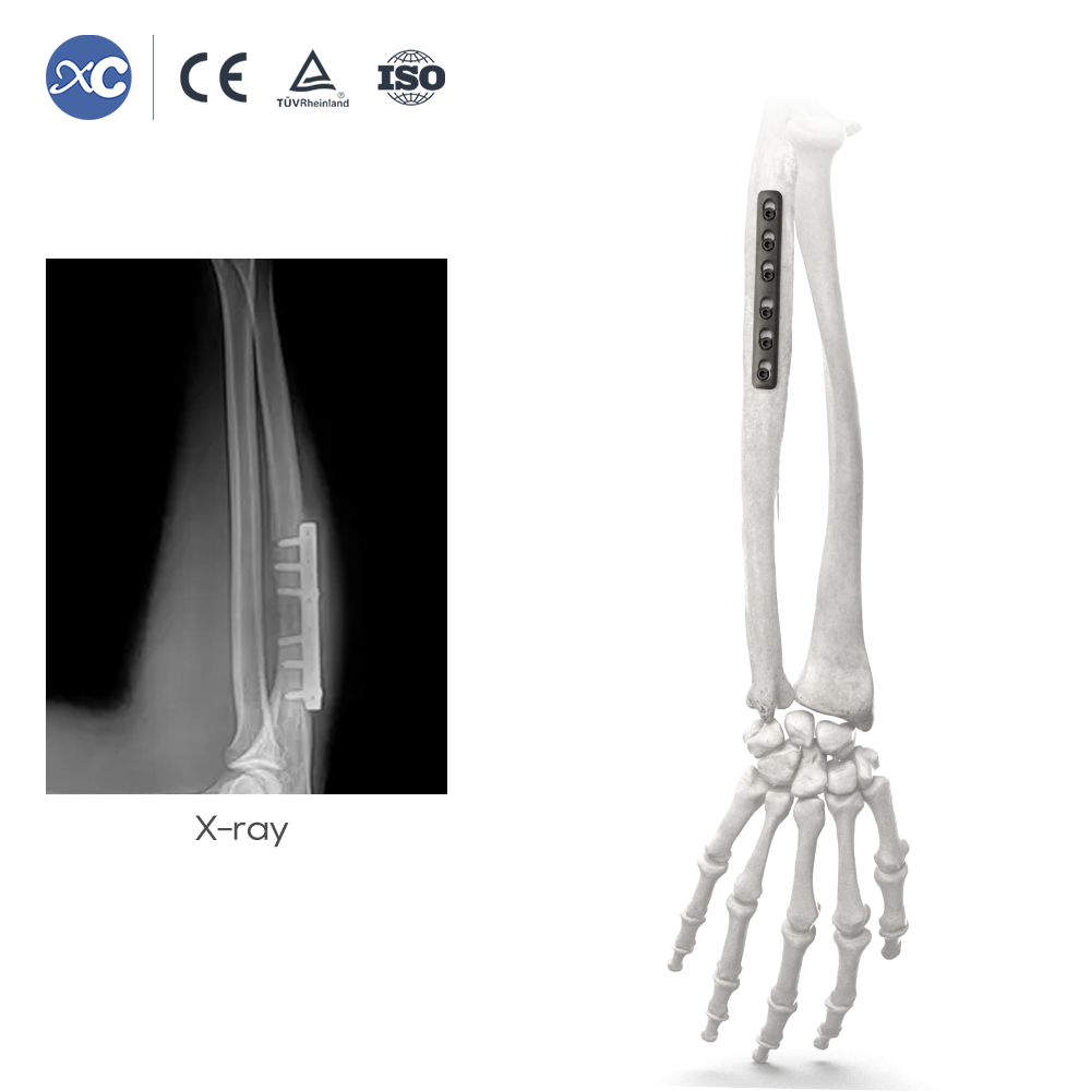 Bassit nga Piraso nga Instrumento nga Pagkandado nga Set - XC Medico