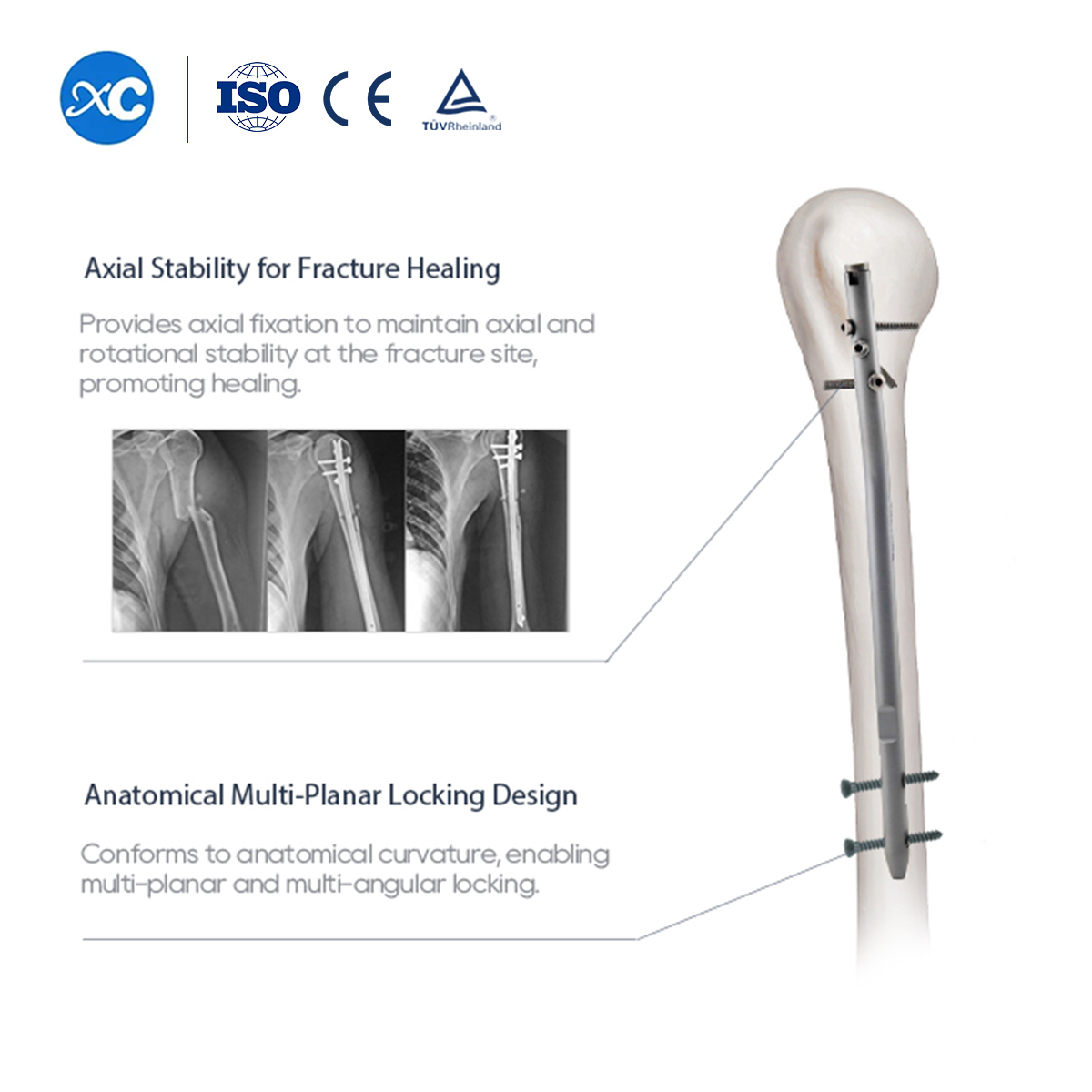 Humeral Interlocking Nail Instrument Set | Trauma | XC Medico