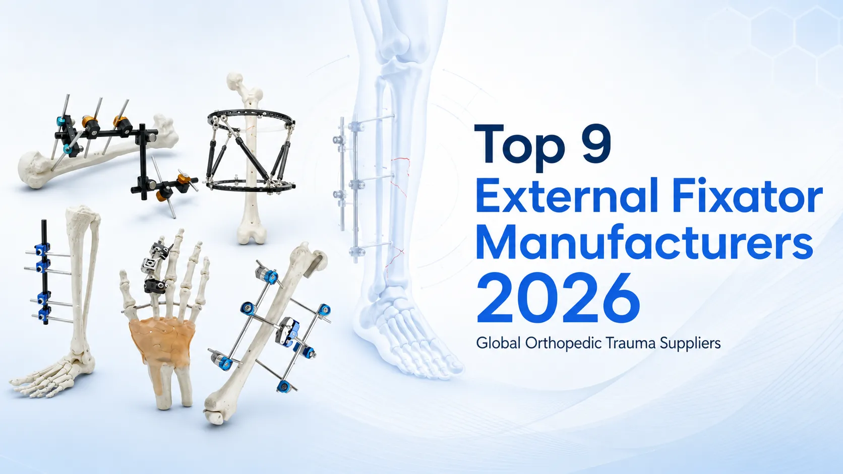 Top external fixator manufacturers and external fixation systems in 2026