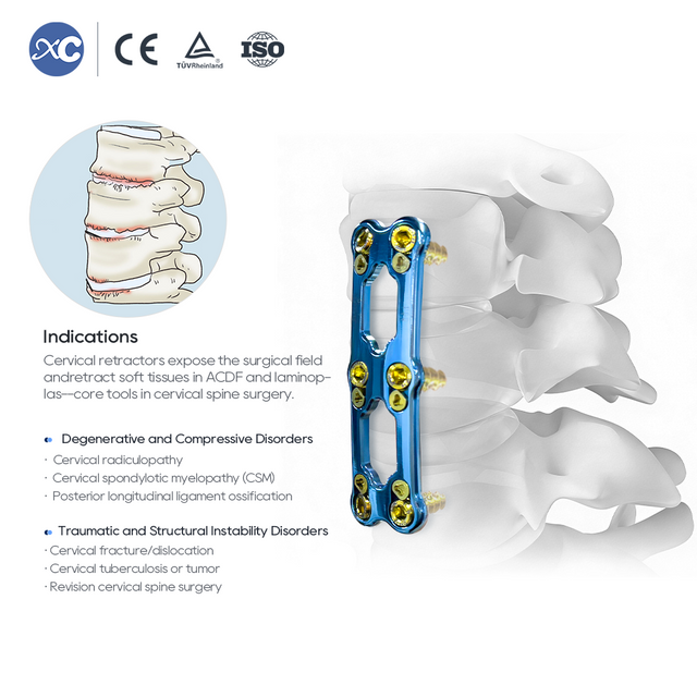 गर्भाशय ग्रीवा रिट्रैक्टर उपकरण सेट | एसीडीएफ सर्जरी | एक्ससी मेडिको