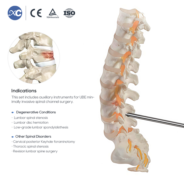 UBE Cirug&iacute;a Espinal Instrumentokuna churasqa - XC Medico