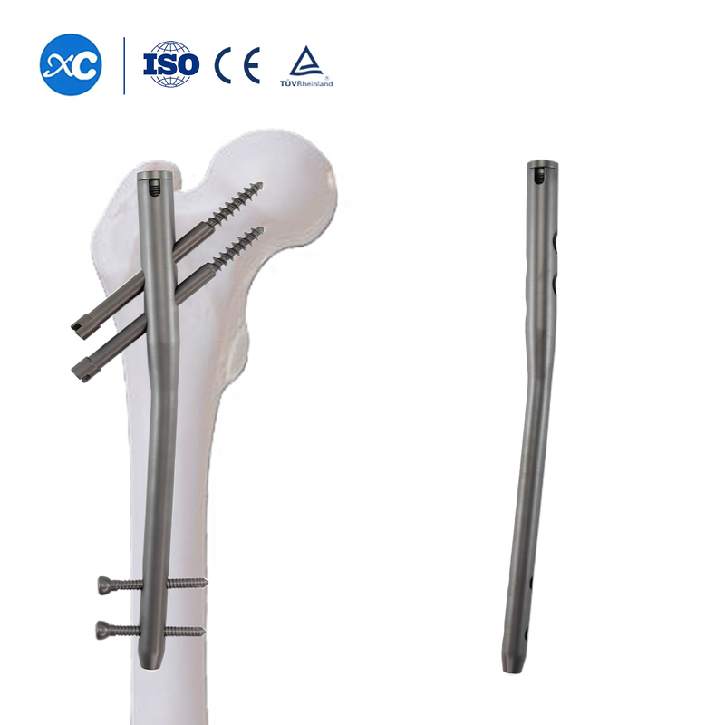Titanium Gamma Nail | Proximal Femoral Fracture Fixation Implants