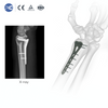 ʻO ka hoʻonohonoho ʻana i nā mea kani ʻo Distal Radius - XC Medico