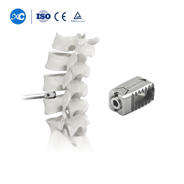 Expandable PVE Cage | MIS-TLIF & UBE Lumbar Fusioun Implantat