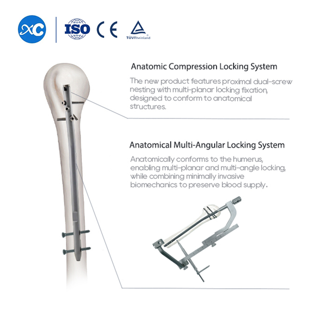 Humeral Interlocking Nail hmanrua Set | Trauma tih hi | XC Medico chuan a rawn ti a