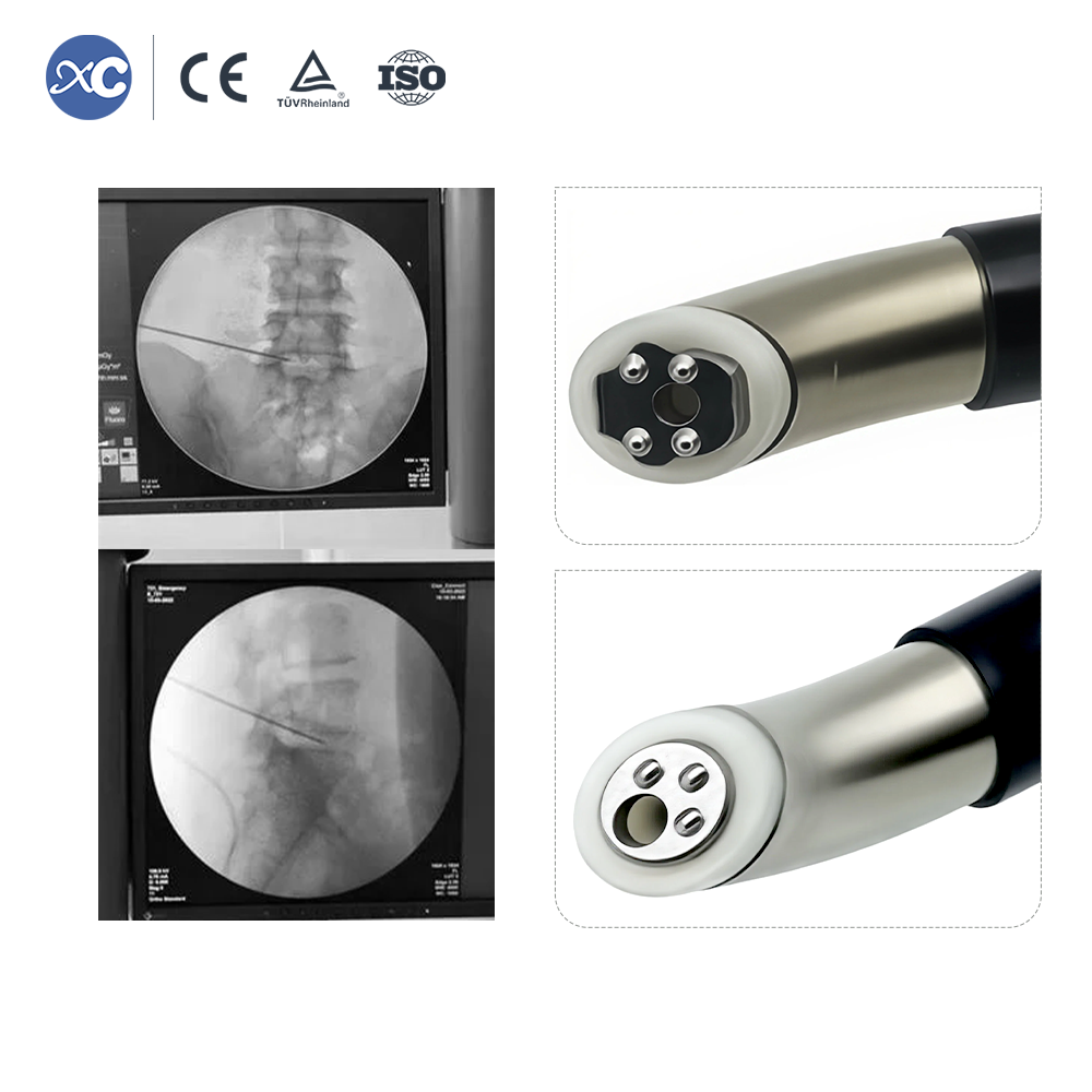 Sistema de Ablaci&oacute;n de Radiofrecuencia Plasma ukaxa | Endoscopia de columna vertebral ukaxa | XC Medico ukax m&auml; jach’a u&ntilde;acht’&auml;wiwa