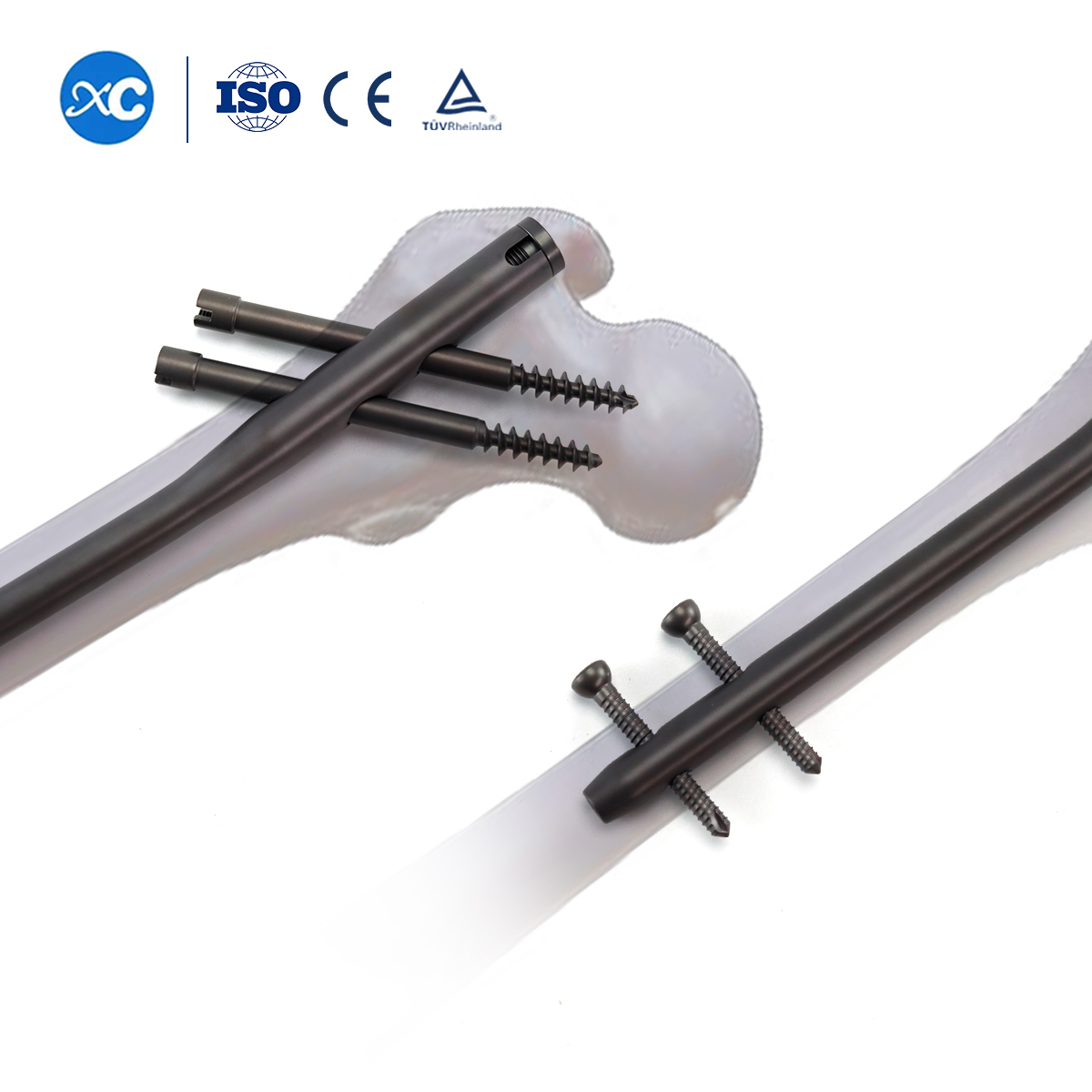 Titanium Gamma Nail | Proximal Femoral Fracture Fixation Implants