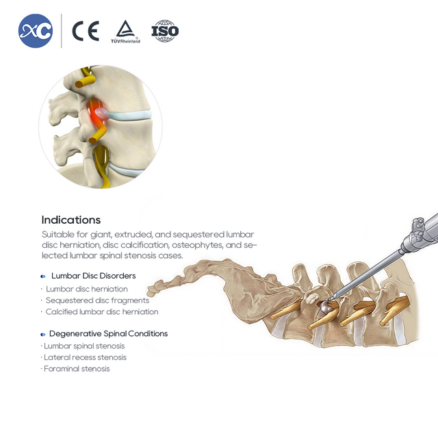 Transforaminal Endoskopik 10.0 Instrument Set | XC Mɛdiko
