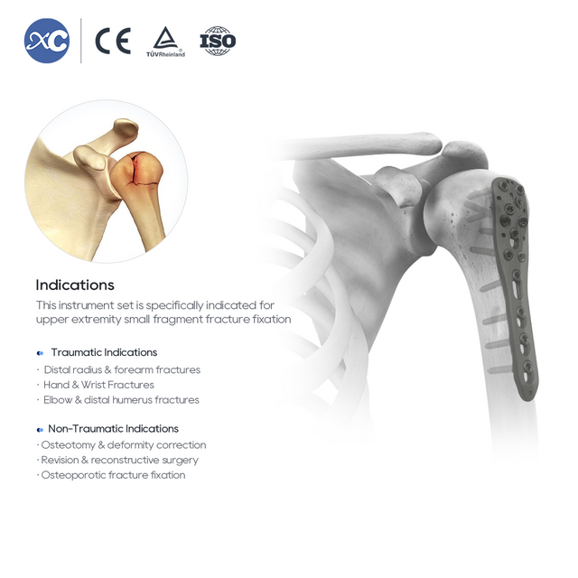 छोट टुकड़ा लॉकिंग साधन सेट - एक्ससी मेडिको